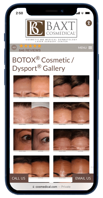 Visit Dr. Baxt to see the Botox Gallery in action